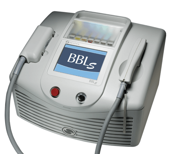 BBL (Broad Band Light) - косметические процедуры, фото