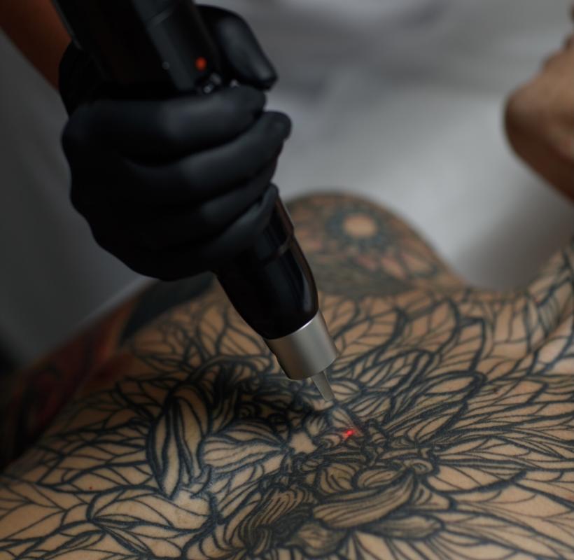 Почему татуировка остается на нашей коже навсегда, а не стирается со временем
