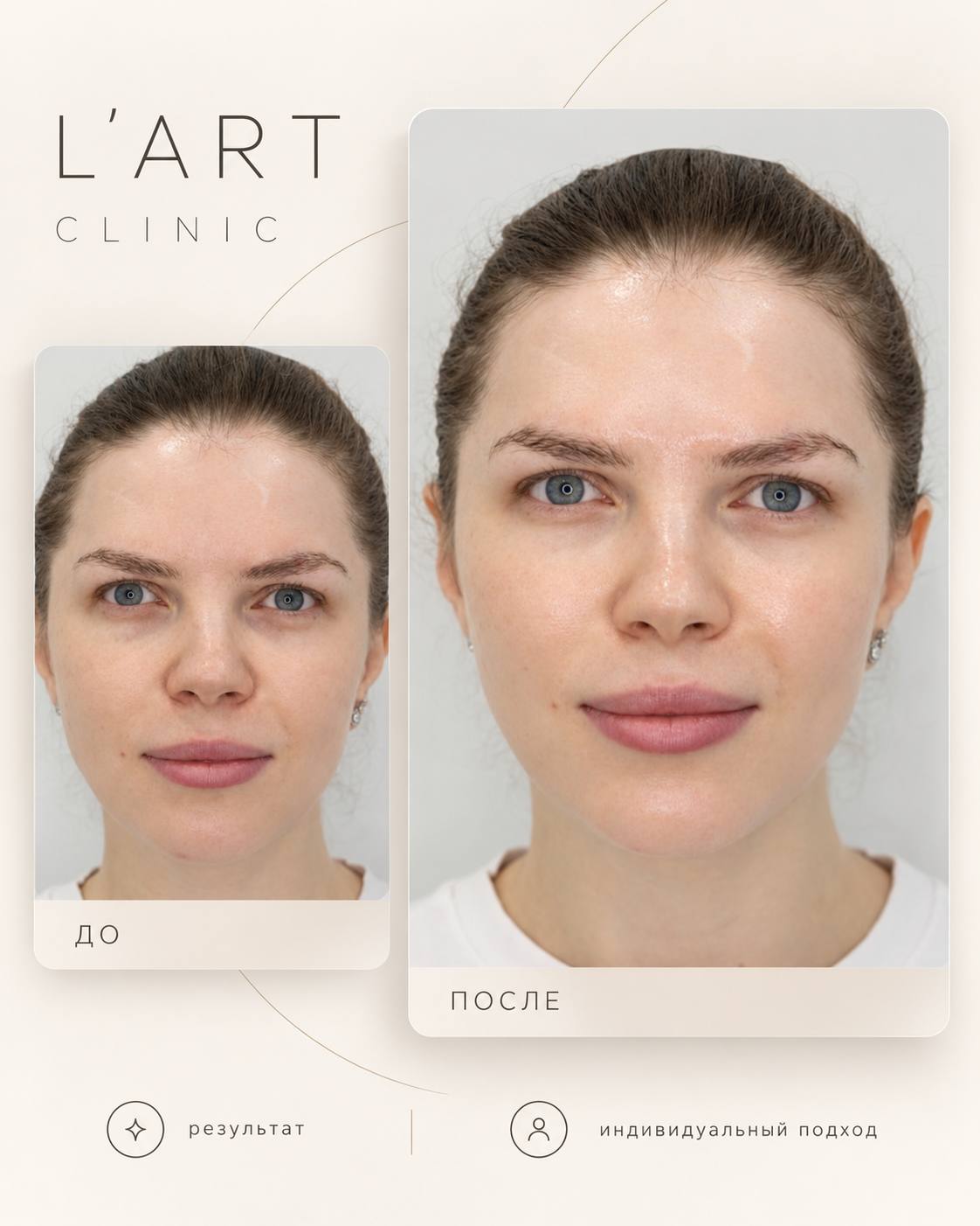 Пилинг Peach Peel в подарок к SkinTyte!