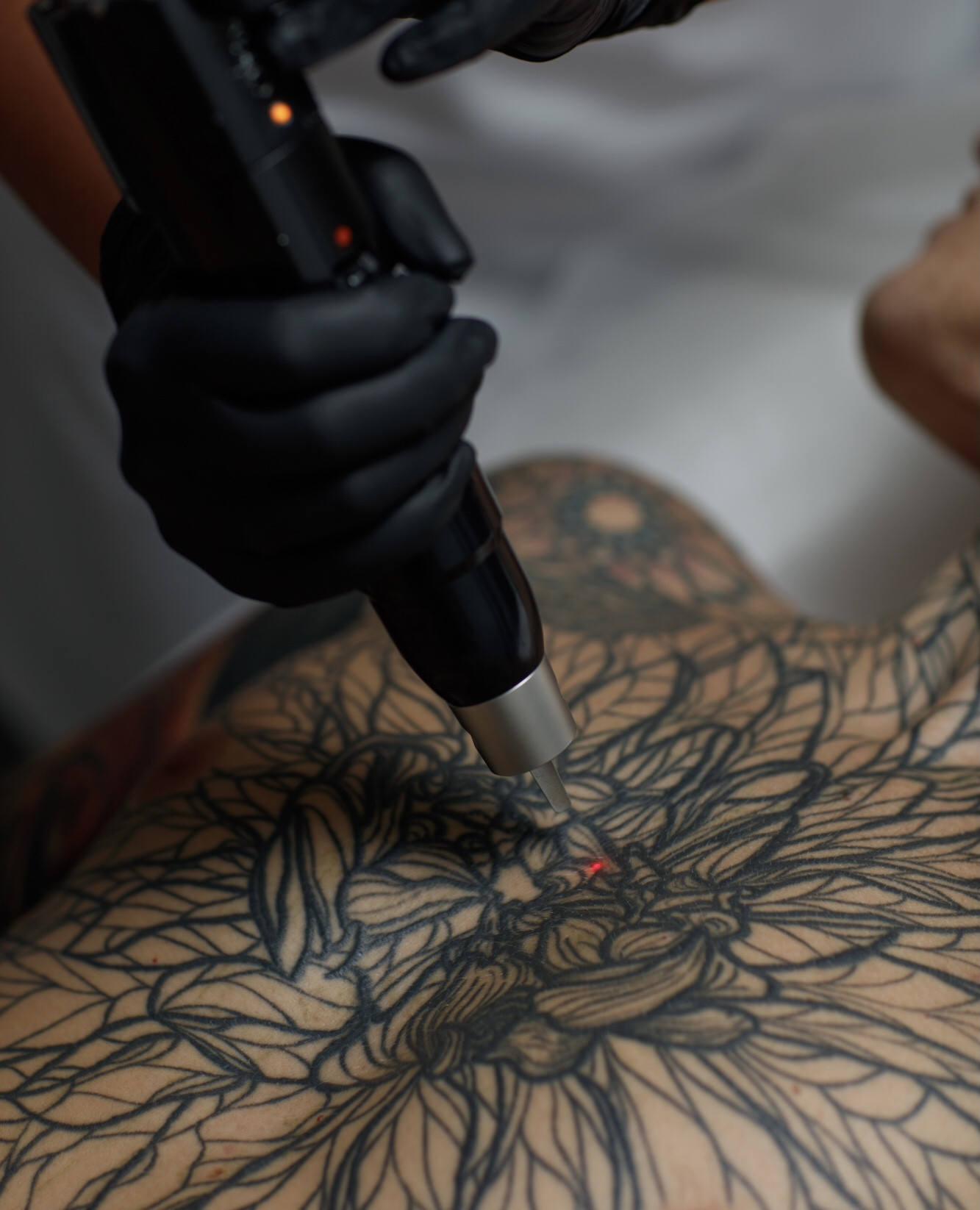 Белые татуировки: красота требует жертв?